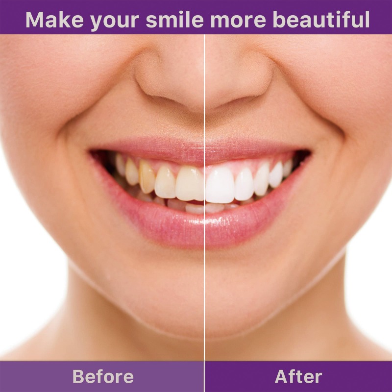 Dentifrice en Mousse V34, 45ml, pour Blanchiment des Dents, Jaune, Remodelé, SAF, Hygiène Buccale, 2024 AI0001 – Image 6