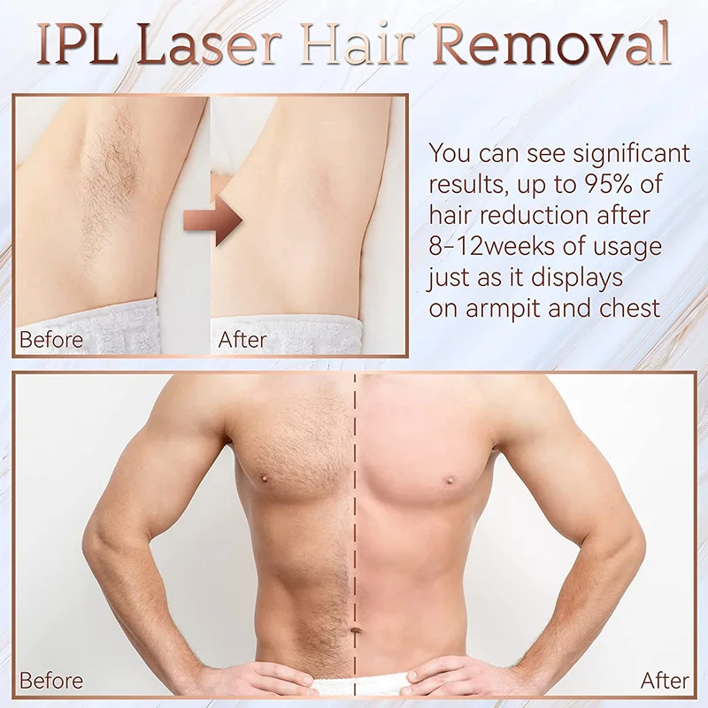 Épilateur laser électrique indolore, photoépilateur en continu IPL, épilation, 2024, 999999 flashs, offre spéciale AI0001 – Image 5